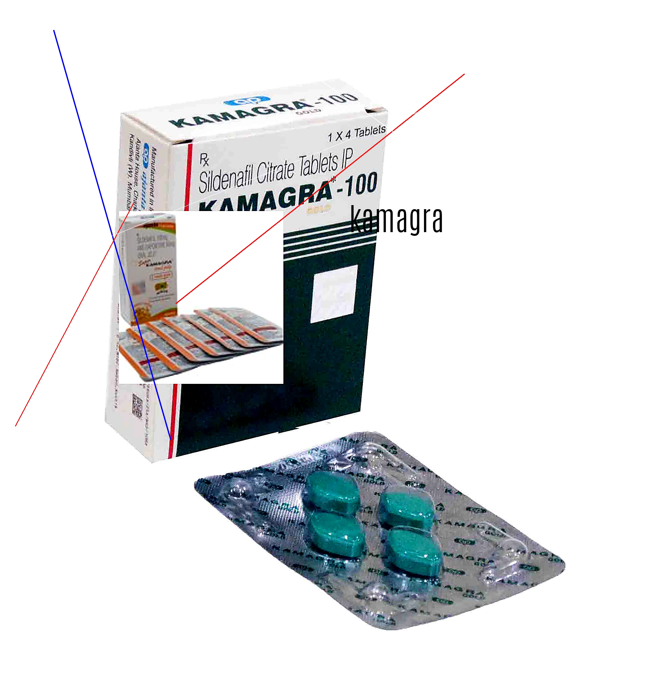 Kamagra en ligne france